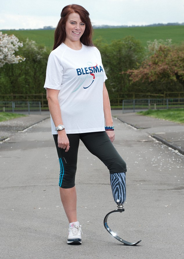 Фантастическое преображение женщины, которая потеряла ногу и ослепла на один глаз после взрыва Ханна Кемпбелл, Hannah Campbell, пластические операции после взрыва, восстановление после взрыва