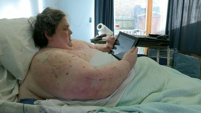 x ray fat person, рентген 400 кг, кейт мартин, x ray keith martin