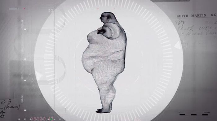 x ray fat person, рентген 400 кг, кейт мартин, x ray keith martin