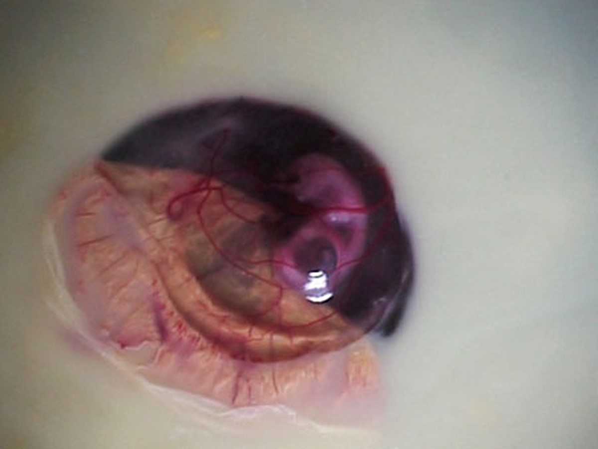 Увлекательный процесс развития цыплёнка в яйце как развивается цыплёнок в яйце, цыплёнок чашка петри