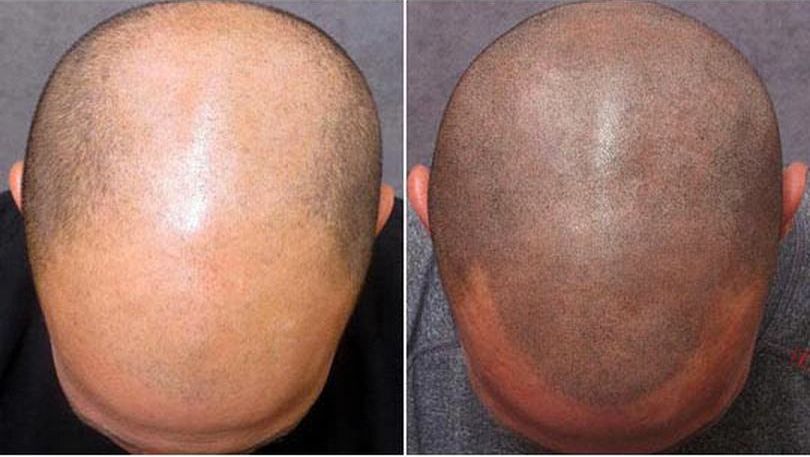 смешной выход из положения, способ выйти из положения, гениальные идеи