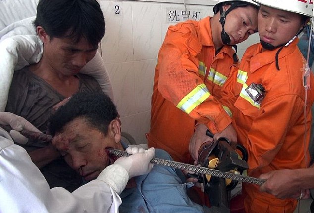 Металлический лом насквозь пробил голову китайца, но тот чудом остался жив лом пробил голову насквозь, металлический прут пробил голову насквозь, упал прут пробил голову насквозь