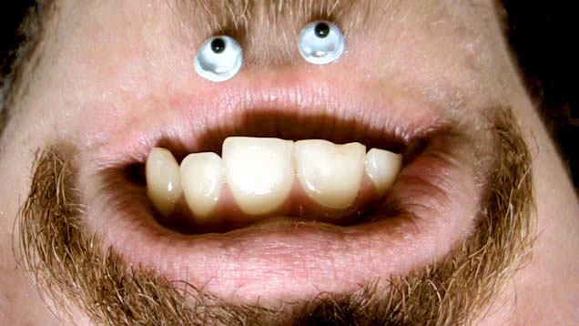 Chinface, глаза на подбородке смешное,глаза на бороде