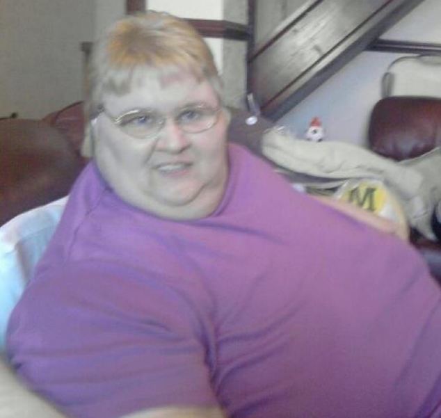 женщина похудела и обзавелась мошонкой, Полина Мол Гиббонс, Pauline Mole Gibbons, My Baggy Body 