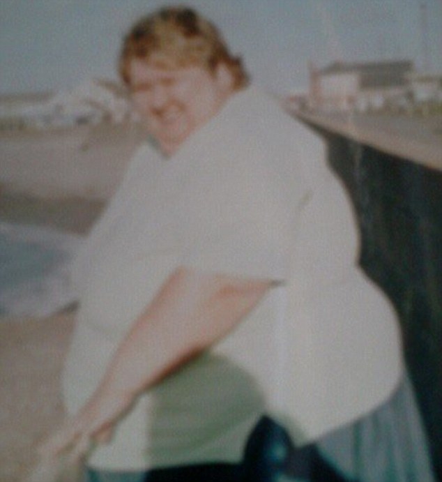 женщина похудела и обзавелась мошонкой, Полина Мол Гиббонс, Pauline Mole Gibbons, My Baggy Body 