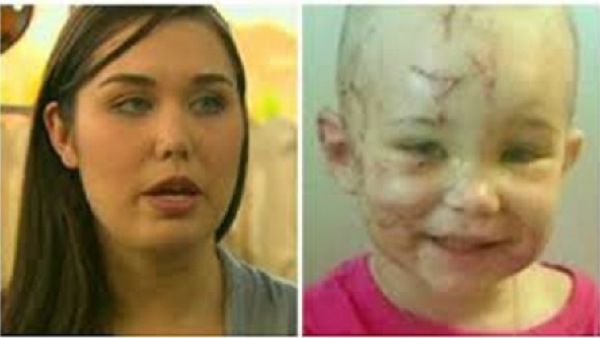 женщина откусила собаке ухо, питбуль напал на ребёнка, Chelsi Camp