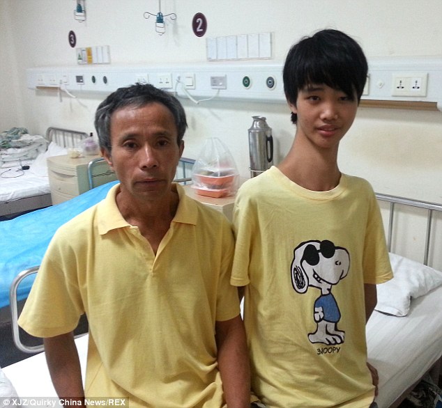 самая длинная шея в мире, Фу Венгуи, Fu Wengui, китайский подросток самая длинная шея