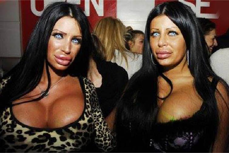 Силиконовые королевы, жертвы пластической хирургии, Сербия, Белград ,Тияна Джуричич Tijana Ðjuričić, Саня Жожич Sanja Jojić