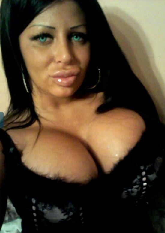 Силиконовые королевы, жертвы пластической хирургии, Сербия, Белград ,Тияна Джуричич Tijana Ðjuričić, Саня Жожич Sanja Jojić