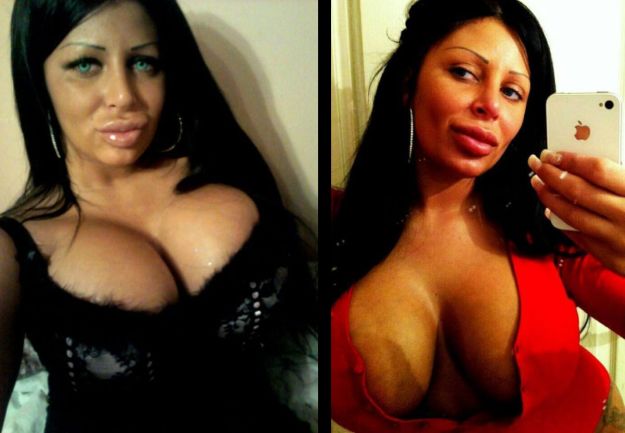 Силиконовые королевы, жертвы пластической хирургии, Сербия, Белград ,Тияна Джуричич Tijana Ðjuričić, Саня Жожич Sanja Jojić