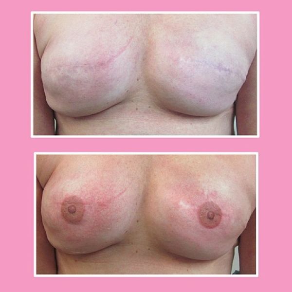 Винсент Майерс, Винни, Vincent Myers, Vinnie , татуировки сосков, рак молочной железы тату