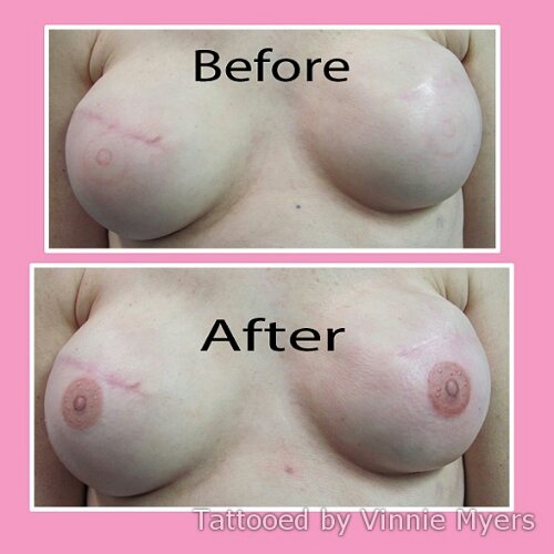 Винсент Майерс, Винни, Vincent Myers, Vinnie , татуировки сосков, рак молочной железы тату