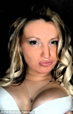 Грудь женщины буквально лопнула из-за установки слишком больших имплантов Неудачное увеличение груди, имплант прорвал кожу, имплант вылез наружу, Клэр Хокер, Claire Hawke