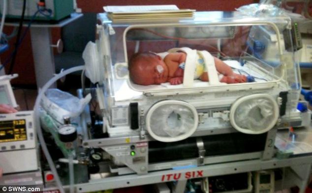 Ребёнок без мозга, мальчик с крошечным мозгом, Ной Волл, Noah Wall