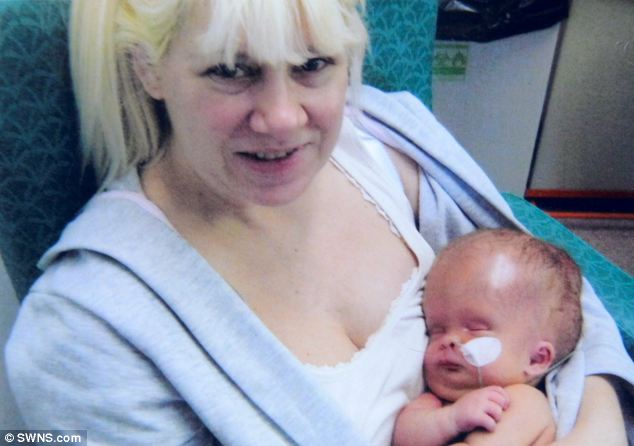 Ребёнок без мозга, мальчик с крошечным мозгом, Ной Волл, Noah Wall