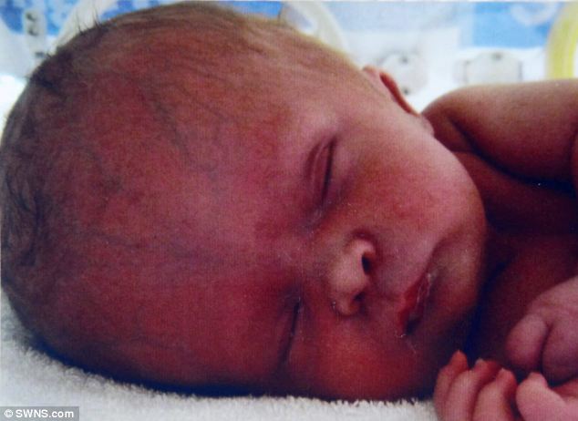 Ребёнок без мозга, мальчик с крошечным мозгом, Ной Волл, Noah Wall