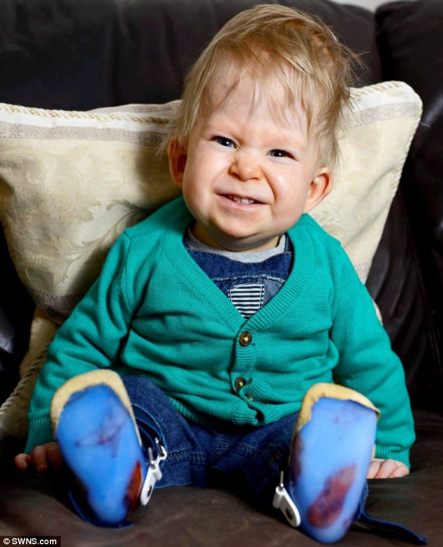 Ребёнок без мозга, мальчик с крошечным мозгом, Ной Волл, Noah Wall