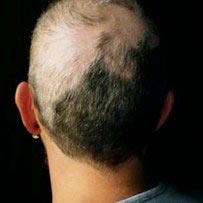 факты о волосах, неприятные факты, неприятные факты о волосах