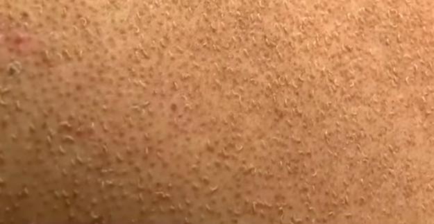 факты о волосах, неприятные факты, неприятные факты о волосах