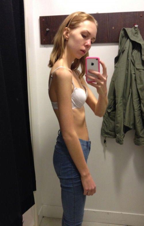 девушка вылечилась от анорексии, из анорексички в спортсменку, анорексичка накачалась, девушка анорексия спорт, дои после анорексии