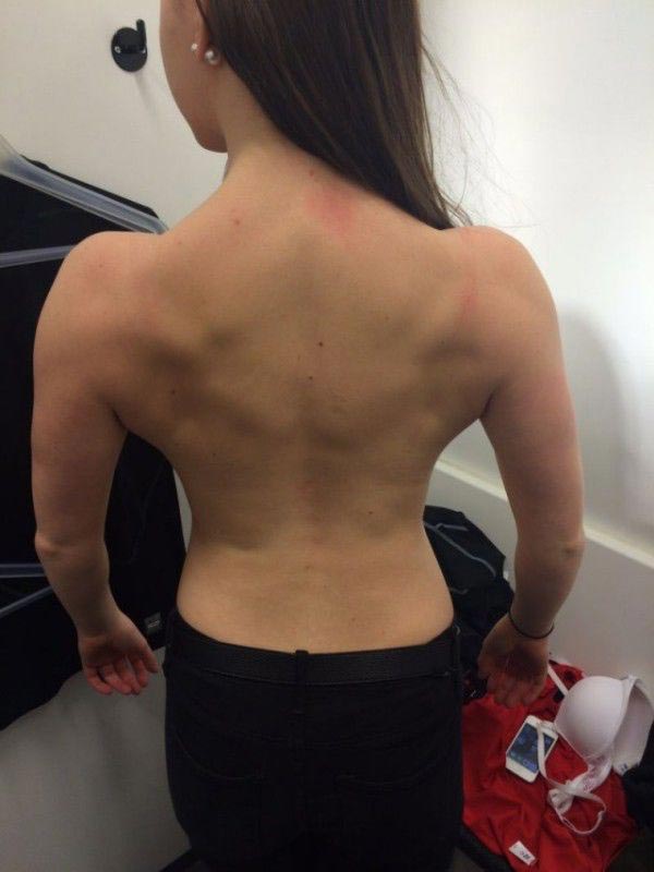 девушка вылечилась от анорексии, из анорексички в спортсменку, анорексичка накачалась, девушка анорексия спорт, дои после анорексии