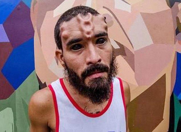 Генри Дэймон, Henry Damon, Генри Дэймон Красный Череп, парень превратил себя в Красного Черепа, бодимодификации Красный Череп