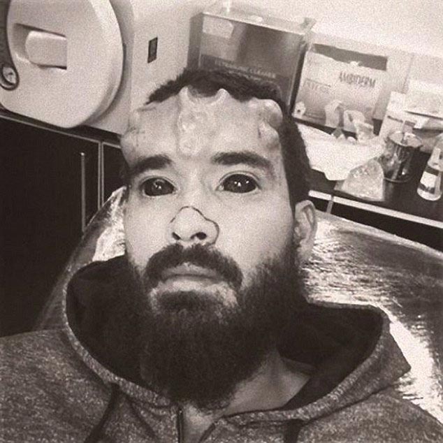 Генри Дэймон, Henry Damon, Генри Дэймон Красный Череп, парень превратил себя в Красного Черепа, бодимодификации Красный Череп