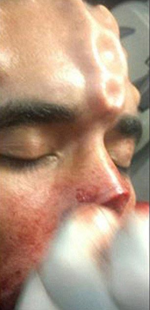 Генри Дэймон, Henry Damon, Генри Дэймон Красный Череп, парень превратил себя в Красного Черепа, бодимодификации Красный Череп