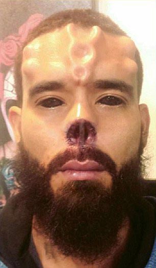 Генри Дэймон, Henry Damon, Генри Дэймон Красный Череп, парень превратил себя в Красного Черепа, бодимодификации Красный Череп