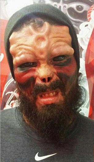 Генри Дэймон, Henry Damon, Генри Дэймон Красный Череп, парень превратил себя в Красного Черепа, бодимодификации Красный Череп