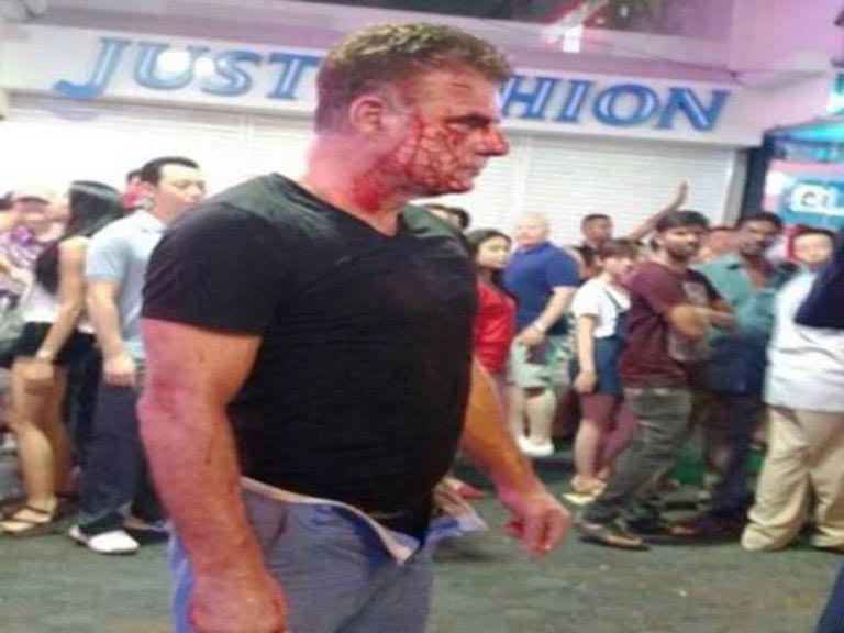 буйный катой, трансвестит избил туриста, трансвестит напал на туриста, Майкл Мерри, Michael Merry, Вичай Шрипаланг, Wichai Sripalang