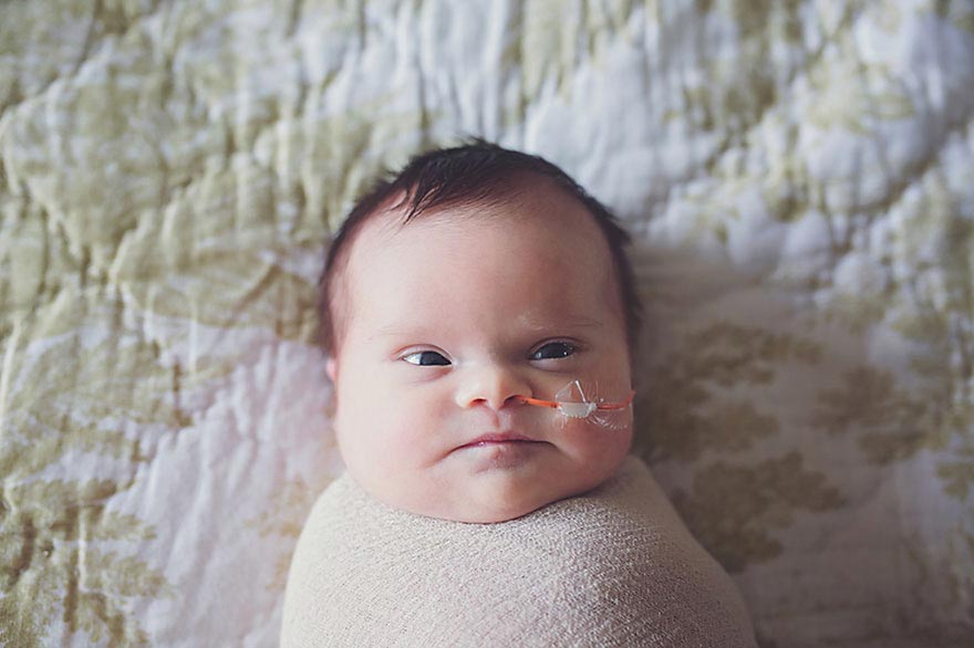 Девочка  с неоперабельной опухолью мозга, Абигейл Джонс, Abigail Jones