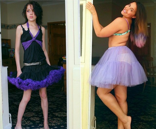 бывшая анорексичка размещает фото в бикини, бодипозитив, Меган Джейн, Megan Jayne