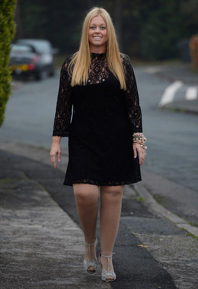 Женщине пришлось откачать 12 литров жира с бедер, чтобы её ноги стали выглядеть нормально лечение липедемы, жир на ногах женщины липедема, пластическая операция липедема, липосакция липедема, откачка жира с ног липедема