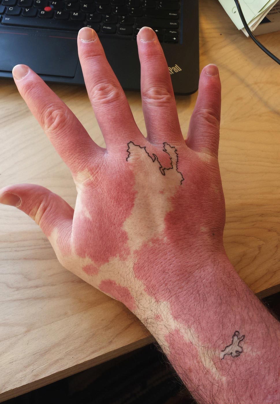 Творческий парень превратил свои уникальные родимые пятна в настоящую карту превратил родимое пятно в карту, обвел родимое пятно чернилам,обвел родимое пятно ручкой