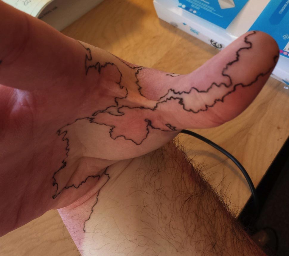 Творческий парень превратил свои уникальные родимые пятна в настоящую карту превратил родимое пятно в карту, обвел родимое пятно чернилам,обвел родимое пятно ручкой