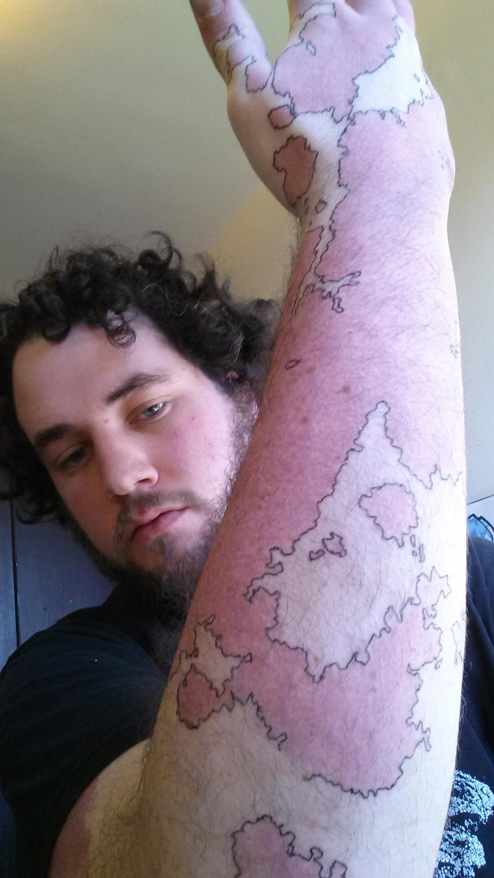 Творческий парень превратил свои уникальные родимые пятна в настоящую карту превратил родимое пятно в карту, обвел родимое пятно чернилам,обвел родимое пятно ручкой