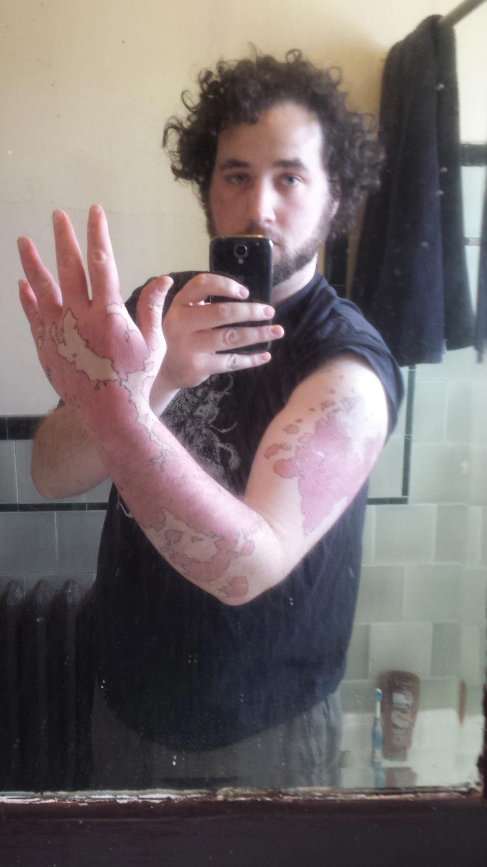 Творческий парень превратил свои уникальные родимые пятна в настоящую карту превратил родимое пятно в карту, обвел родимое пятно чернилам,обвел родимое пятно ручкой