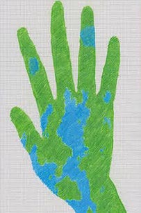 превратил родимое пятно в карту, обвел  родимое пятно чернилам,обвел  родимое пятно ручкой