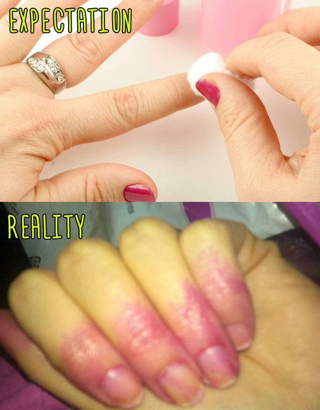 Ожидание против реальности, ужасно накрашенные ногти, девушки пытались повторить маникюр  