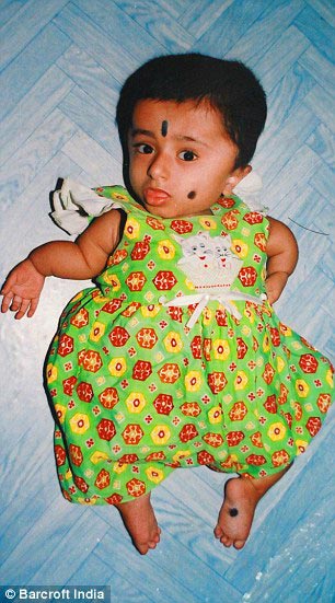 Гириджа Шринивас,Girija Srinivas, девушка в теле 2-летней девочки, девушка в теле двухлетней девочки, 