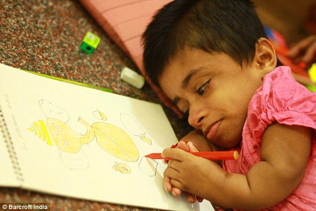 Гириджа Шринивас,Girija Srinivas, девушка в теле 2-летней девочки, девушка в теле двухлетней девочки, 