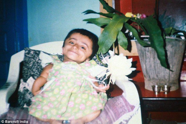 Гириджа Шринивас,Girija Srinivas, девушка в теле 2-летней девочки, девушка в теле двухлетней девочки, 