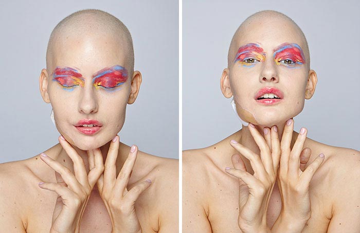 Елизавета Блухова,Elizaveta Bulokhova, сделать аборт рак челюсти, модель рак челюсти сделать аборт