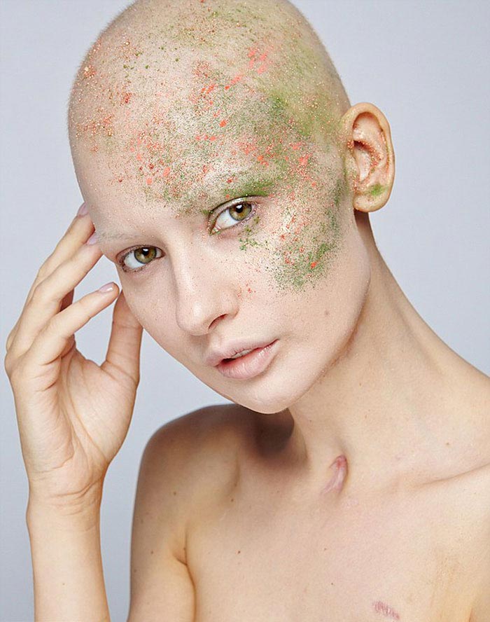 Елизавета Блухова,Elizaveta Bulokhova, сделать аборт рак челюсти, модель рак челюсти сделать аборт