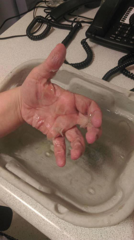 девушке приклеили руку к дверной ручке, приклеили суперклеем руку к дверной ручке, Фиона Крэбб, Fiona Crabb