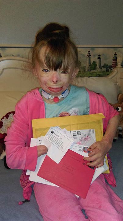 Сафайр Терри, Safyre Terry, обгоревшая девочка рождественские открытки, обгоревшая девочка просит прислать открытки на Рождество