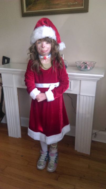 Сафайр Терри, Safyre Terry, обгоревшая девочка рождественские открытки, обгоревшая девочка просит прислать открытки на Рождество