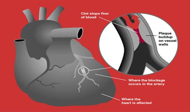 ироничные истории совпадения, невероятные совпадения, совпадение не думаю