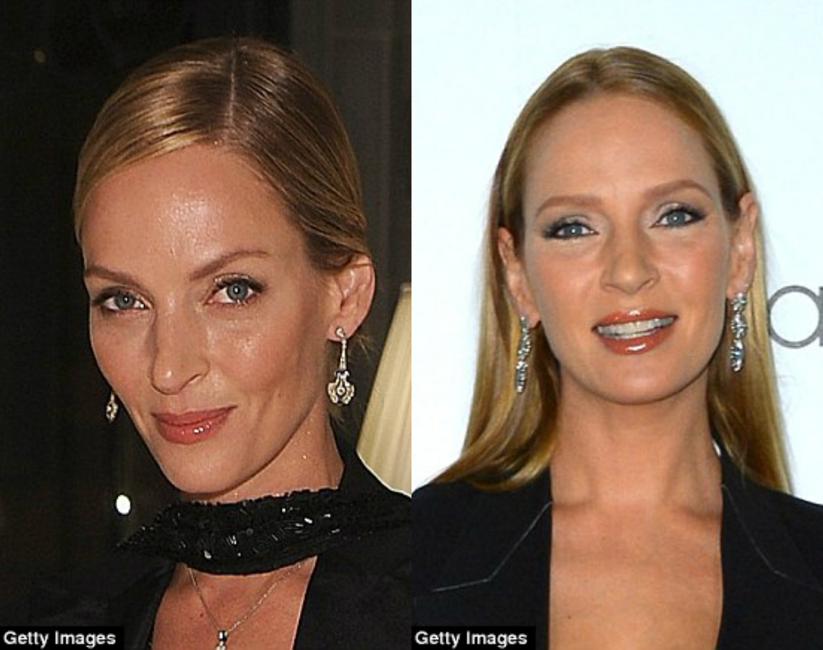 Ума Турман изменилось до неузнаваемости, ума турман 2015, ума турман пластическая операция, Uma Thurman face